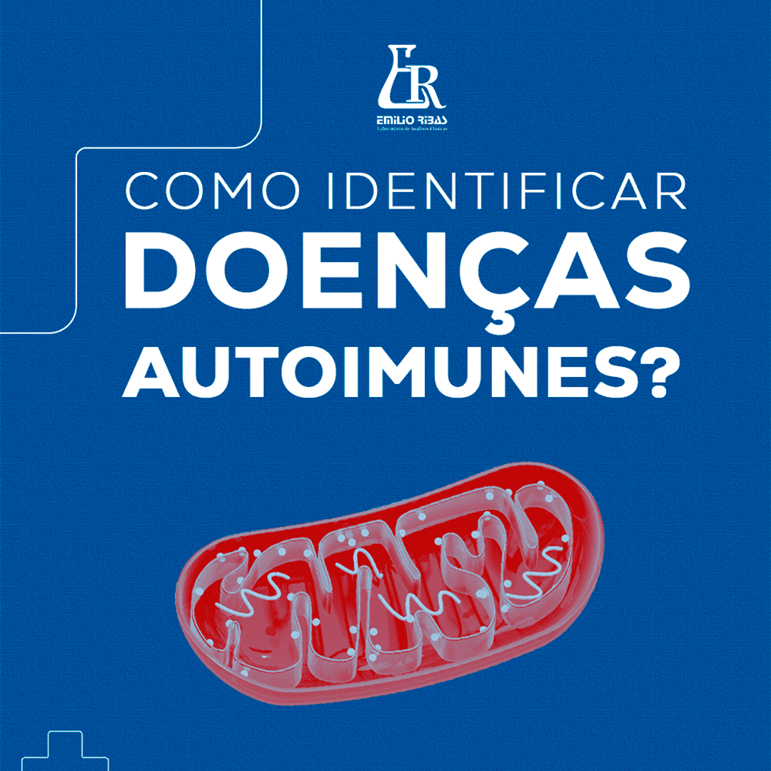 Como identificar doenças autoimunes?