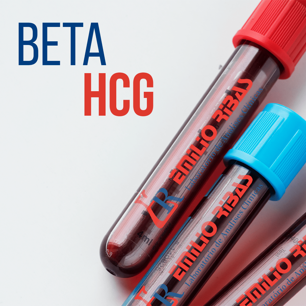 Beta HCG