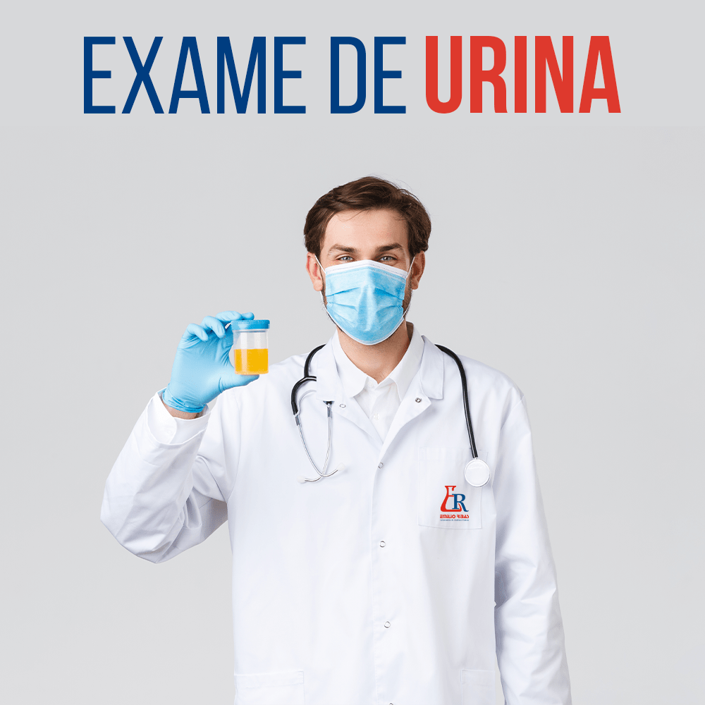 Exame de Urina