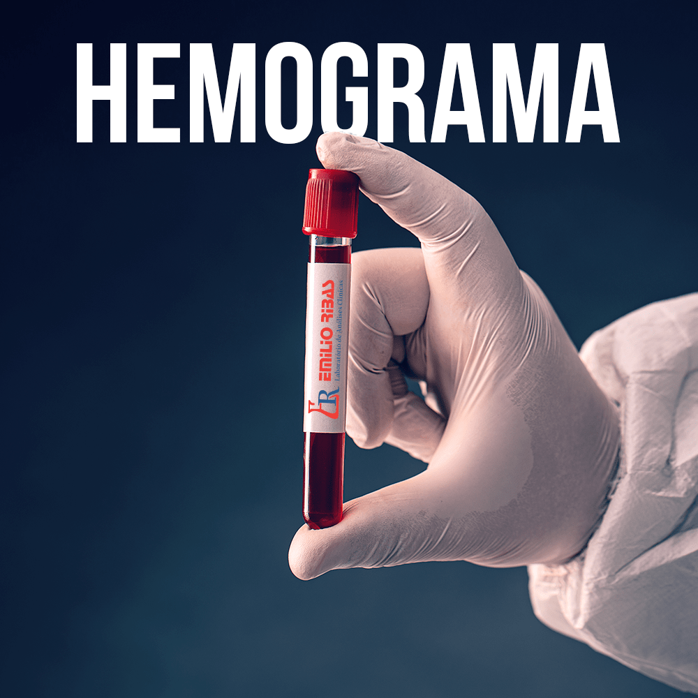 Hemograma