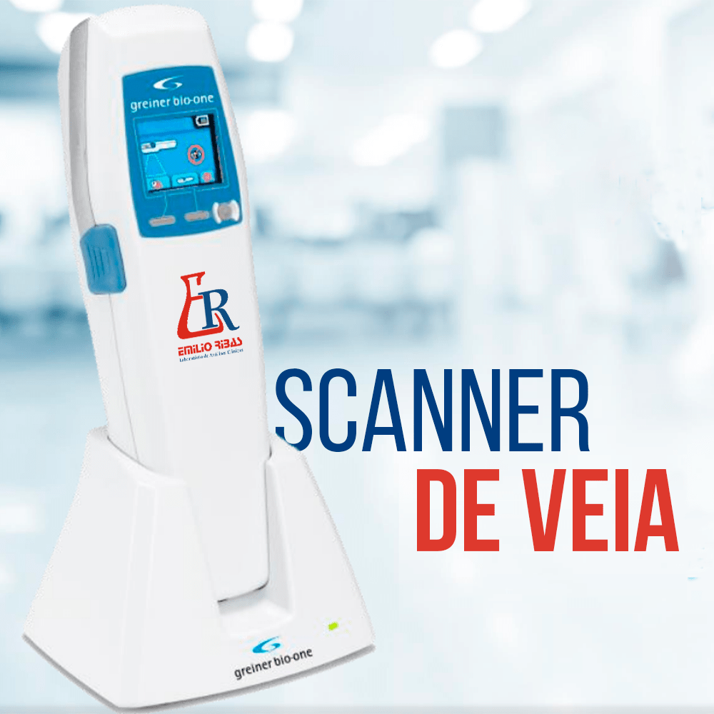 Scanner de Veia